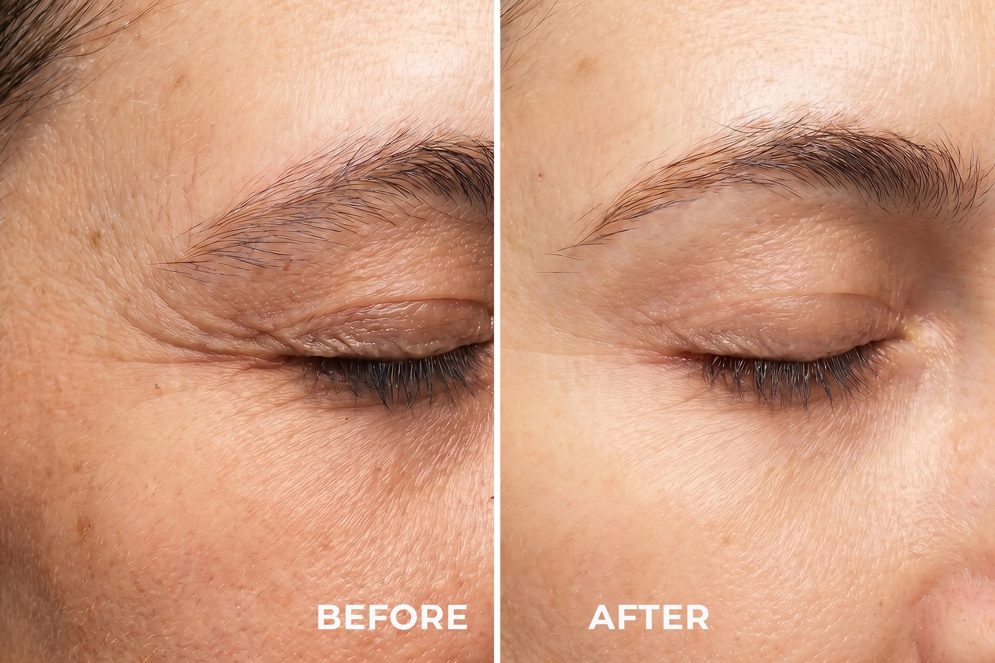 AI NEW - DISPOSITIF POUR LA PEAU AUTOUR DES YEUX 