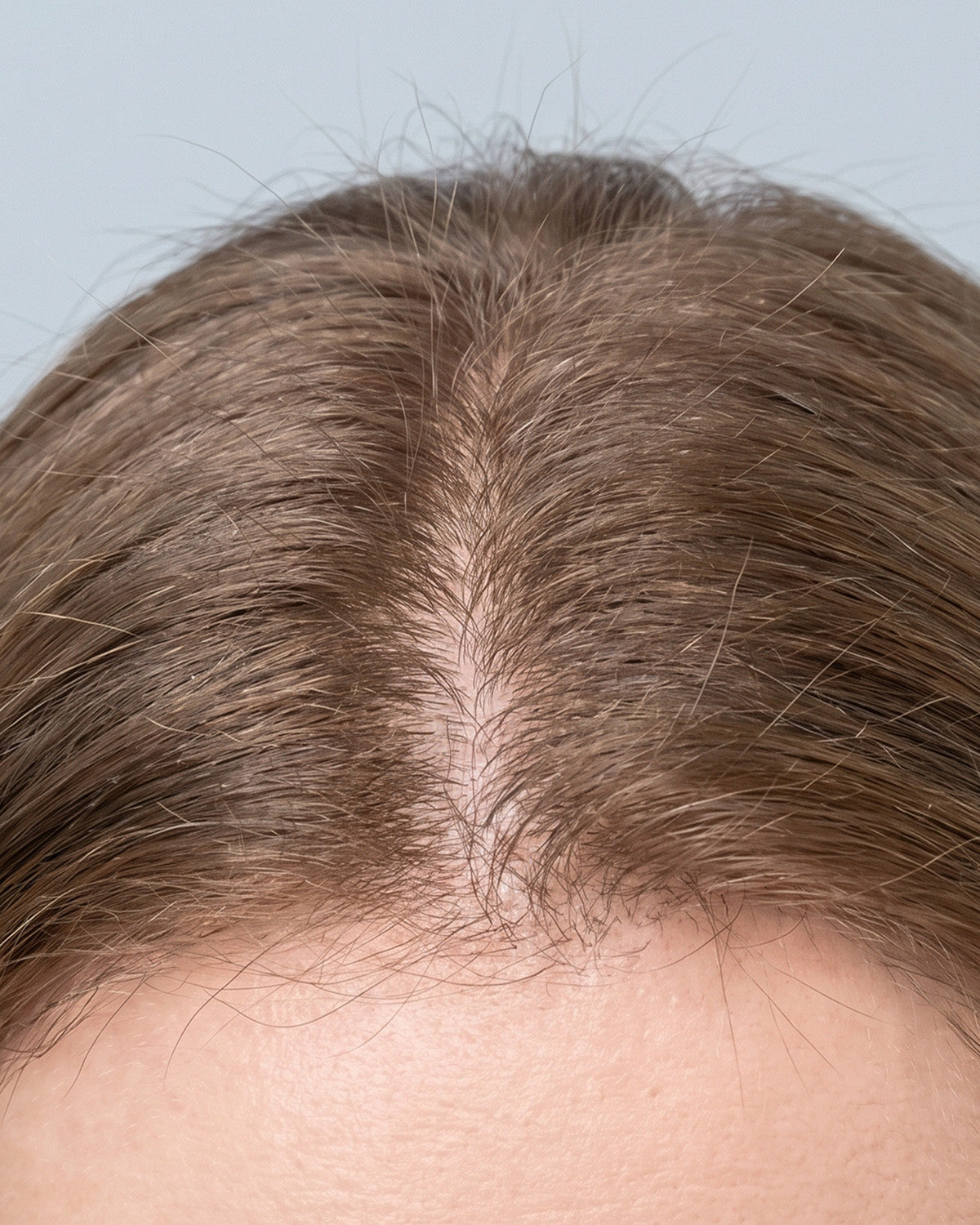Hair roots and parting after using WAU ATAMA