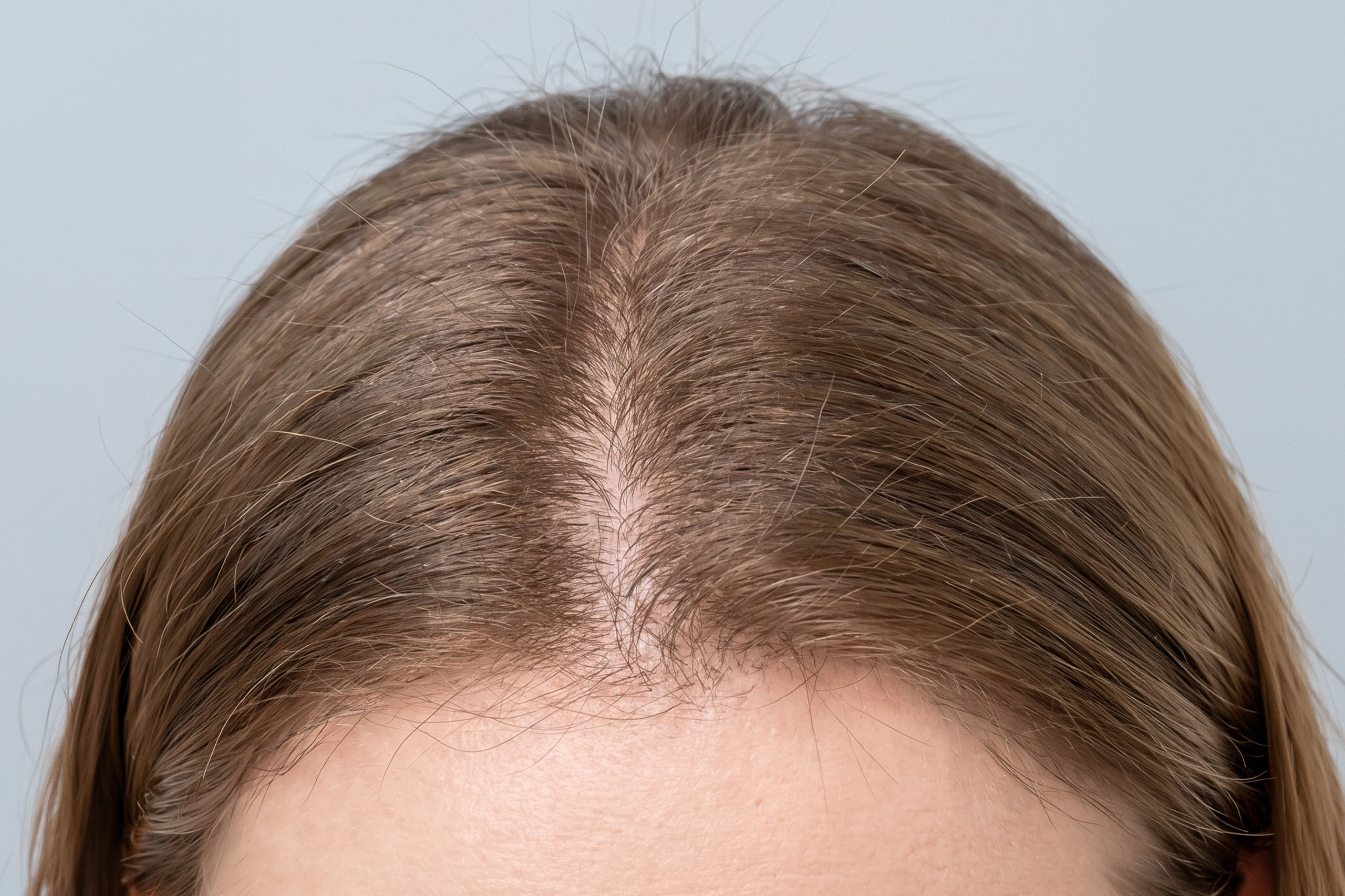 Hair roots and parting after using WAU ATAMA