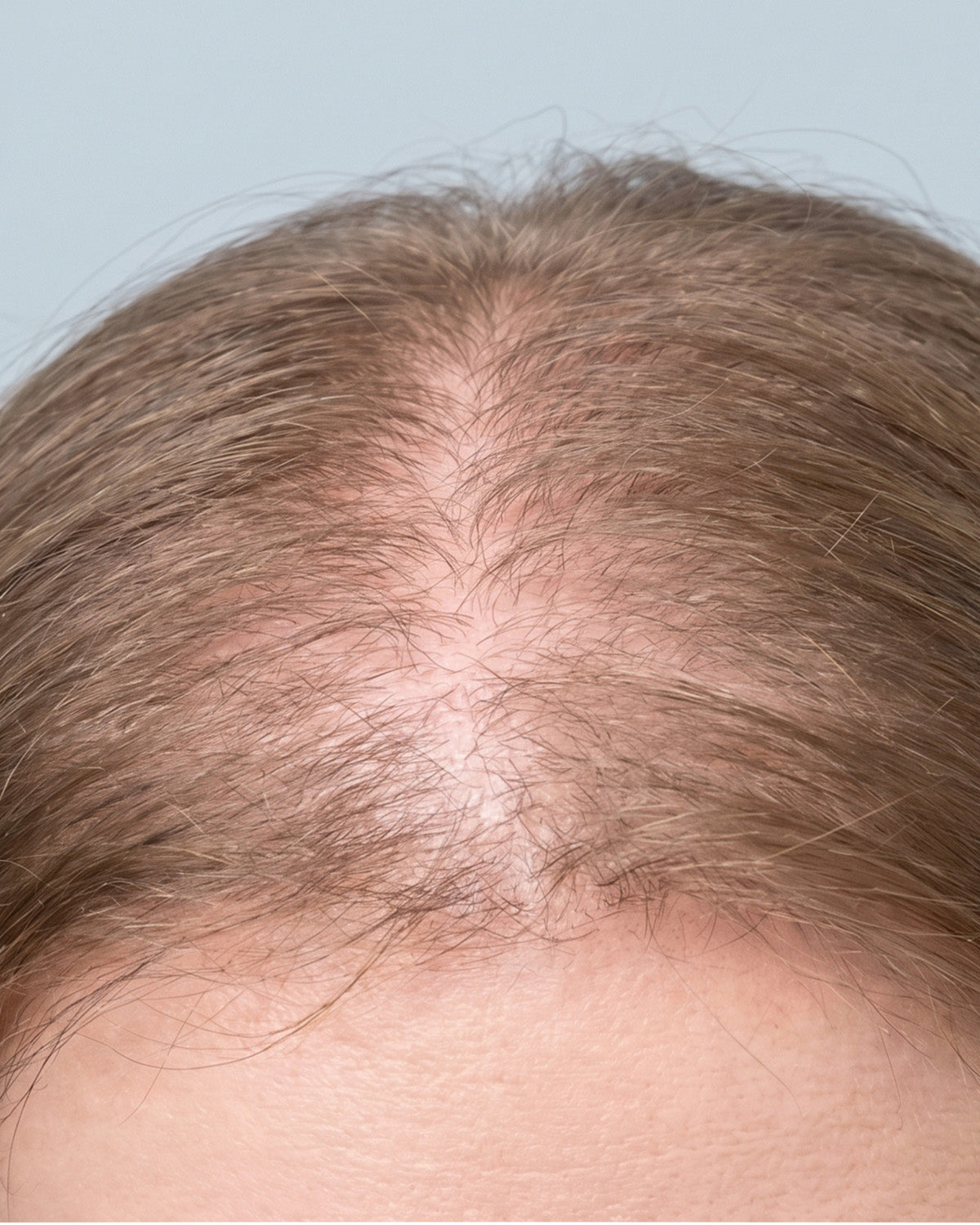 Hair roots and parting before using WAU ATAMA