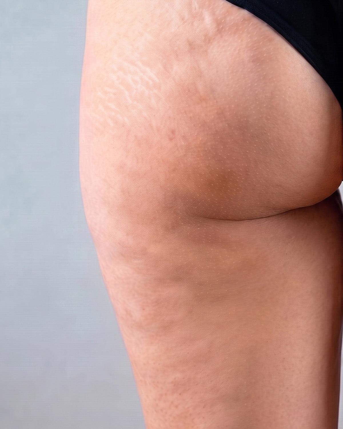 Body area after using WAU KIO