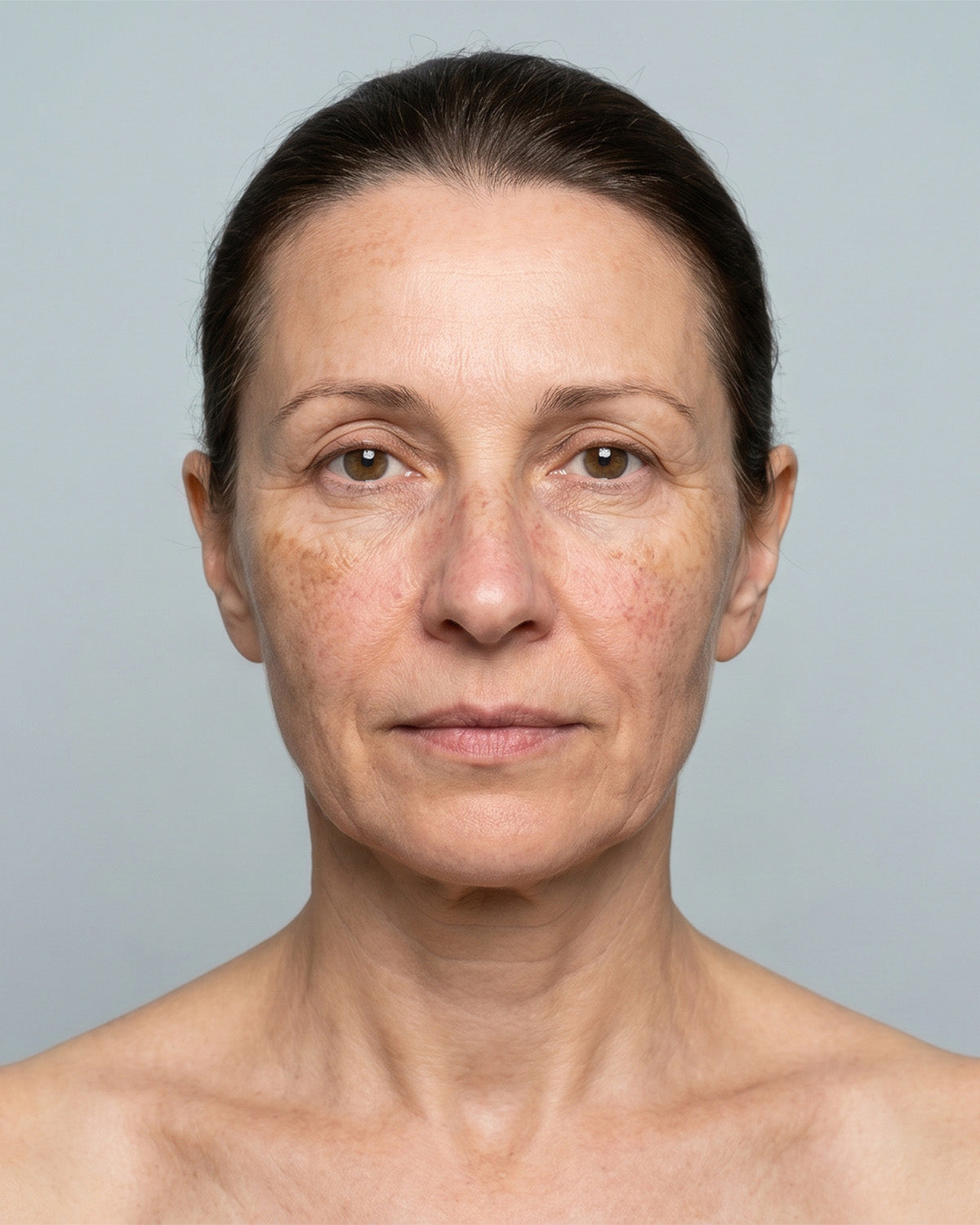 Face and décolleté before using WAU LED SET