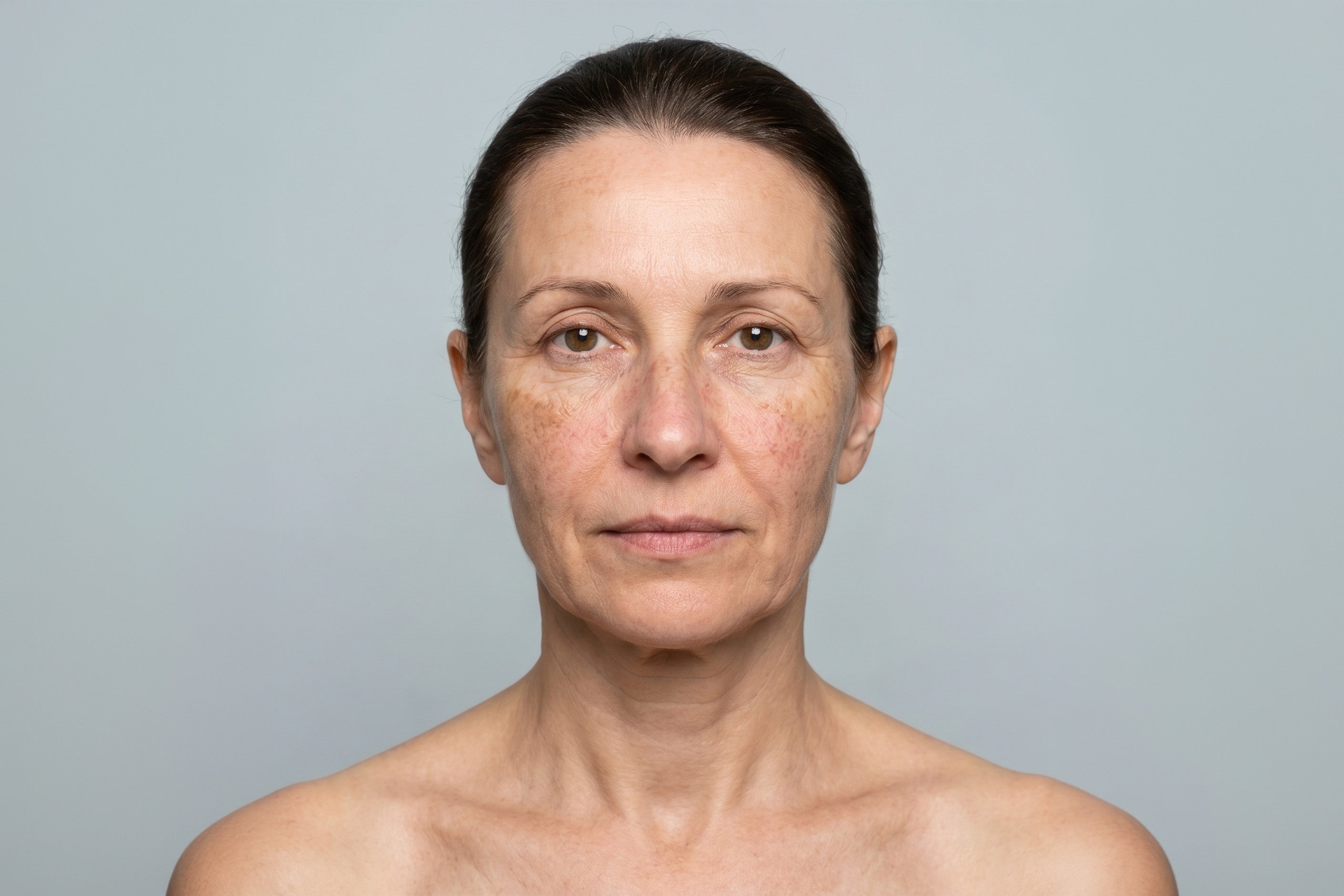 Face and décolleté before using WAU LED SET
