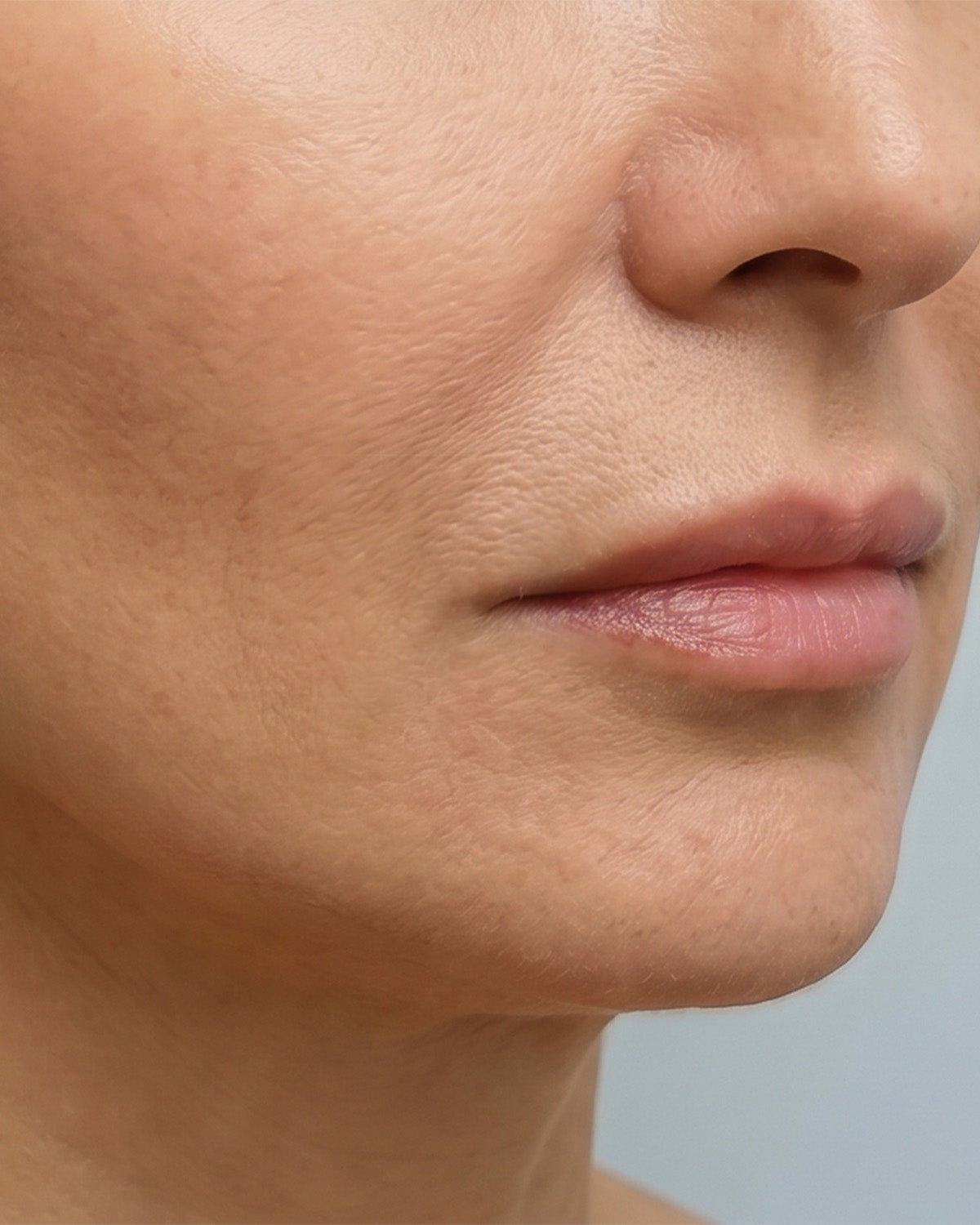 Facial contour after using WAU VIA GOLD