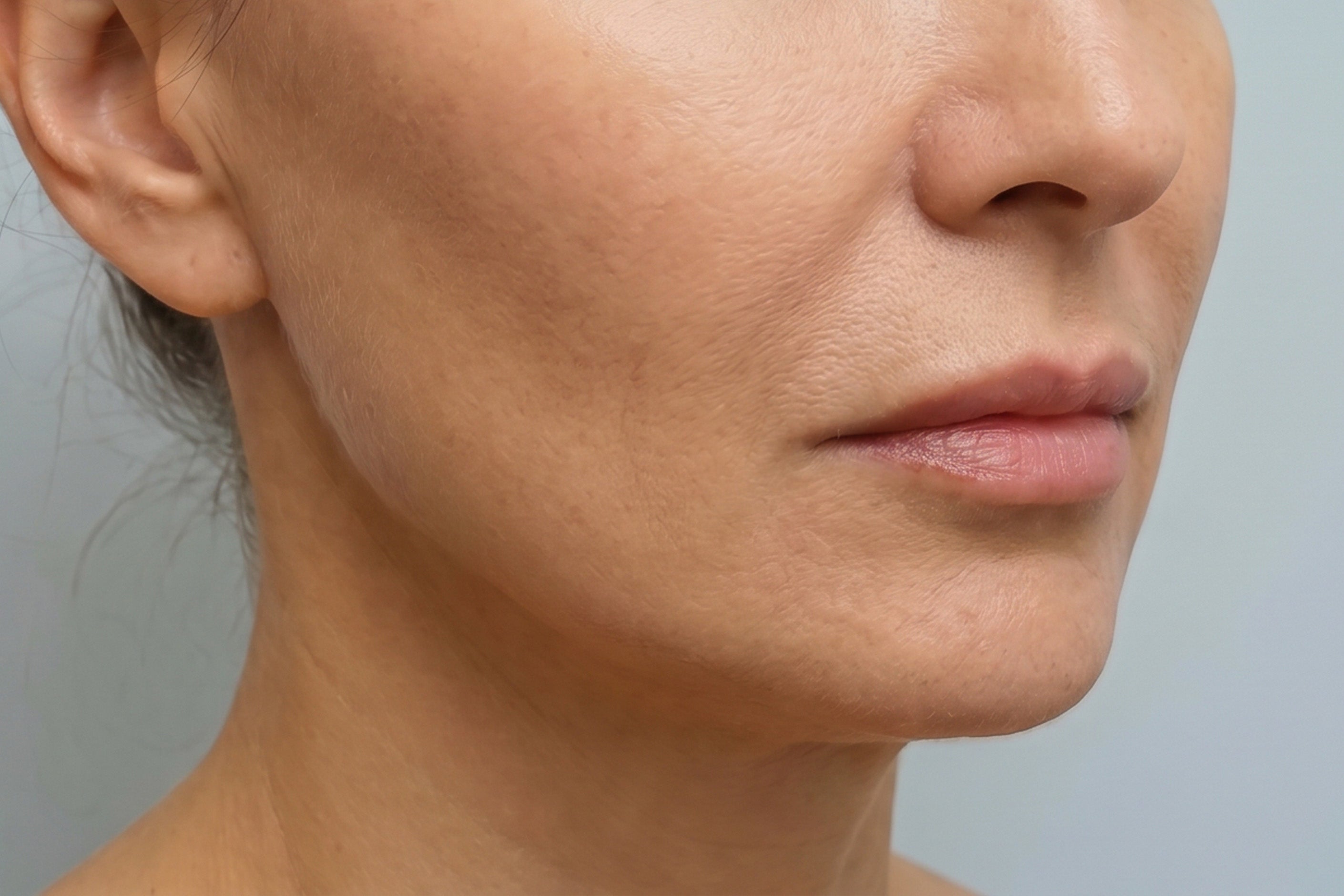 Facial contour after using WAU VIA GOLD