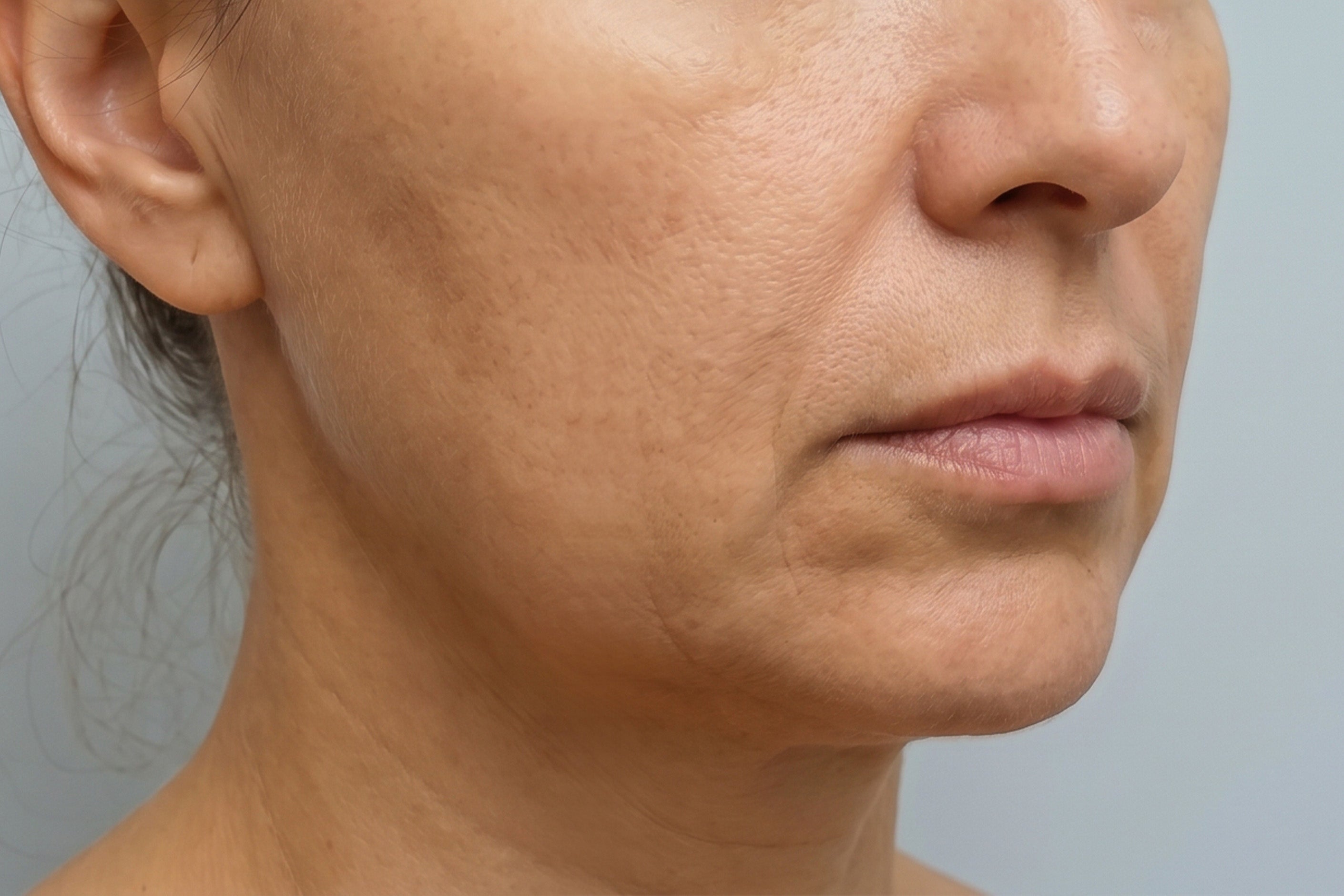 Facial contour before using WAU VIA GOLD